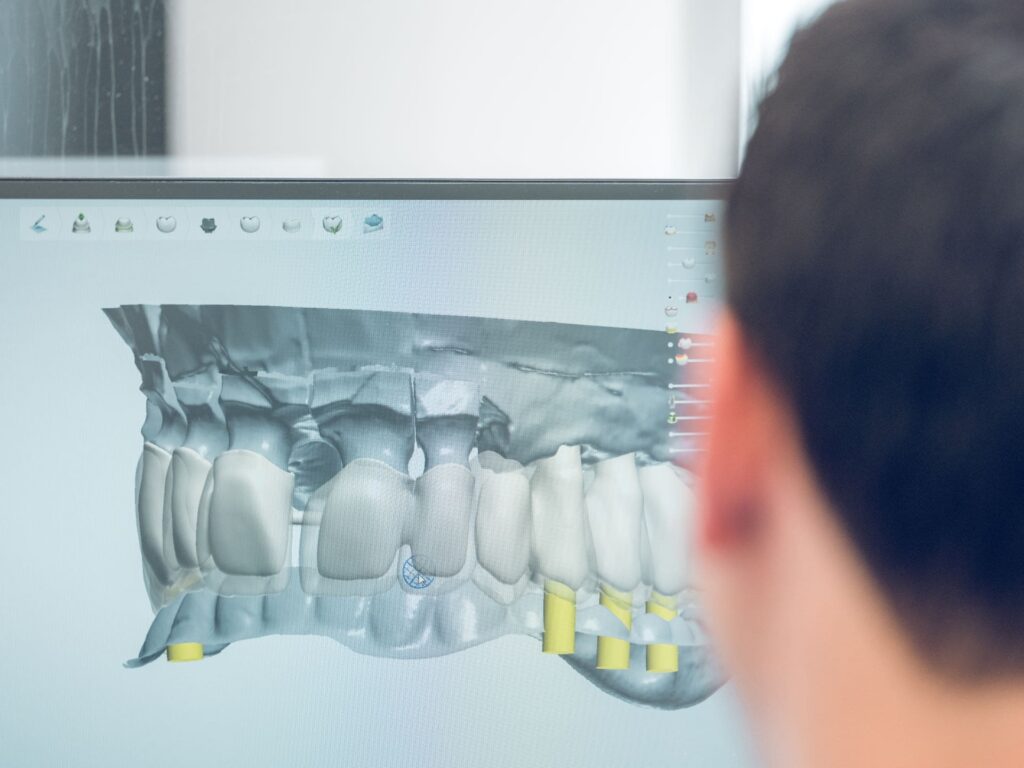 doctor working with digital jaw model
