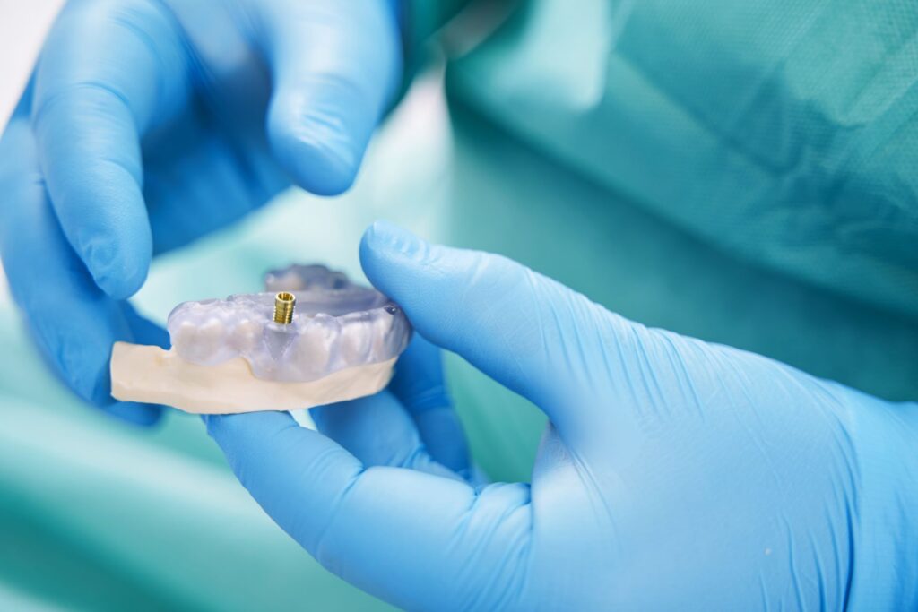 dentist holding teeth model with metal dental implat